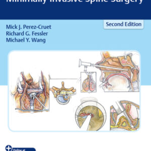 An Anatomic Approach to Minimally Invasive Spine Surgery 2nd Edition - Original PDF