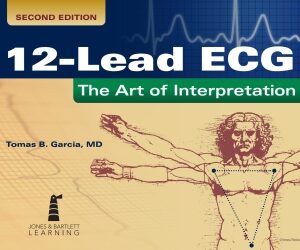 12-Lead ECG: The Art of Interpretation 2nd Edition - Original PDF