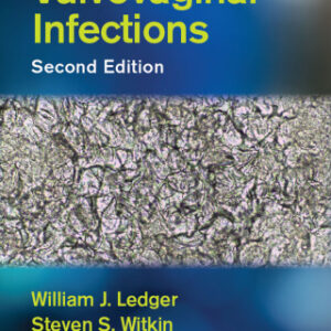 Vulvovaginal Infections 2nd Edition - Original PDF