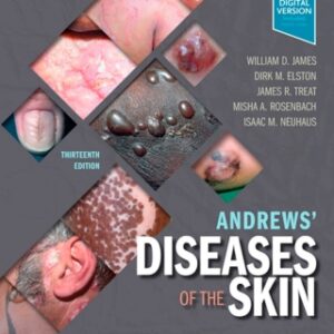 Andrews' Diseases of the Skin: Clinical Dermatology 13th Edition - Original PDF