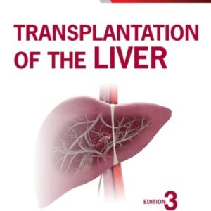 Transplantation of the Liver 3rd Edition - Original PDF