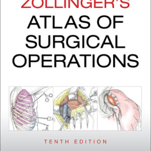 Zollinger's Atlas of Surgical Operations 10th Edition - Original PDF