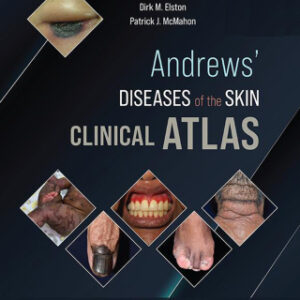 Andrews' Diseases of the Skin Clinical Atlas 2nd Edition - Original PDF