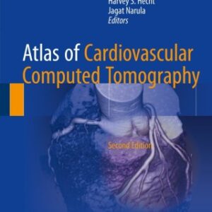 Atlas of Cardiovascular Computed Tomography 2nd Edition - Original PDF