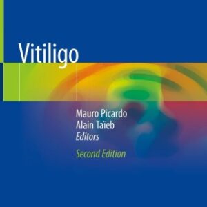 Vitiligo 2nd Edition - Original PDF