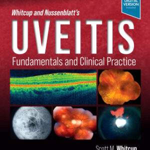 Whitcup and Nussenblatt's Uveitis: Fundamentals and Clinical Practice 5th Edition - Original PDF