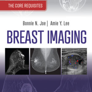 Breast Imaging, E-Book: The Core Requisites 4th Edition - Original PDF