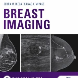 Breast Imaging: The Requisites E-Book 3rd Edition - Original PDF