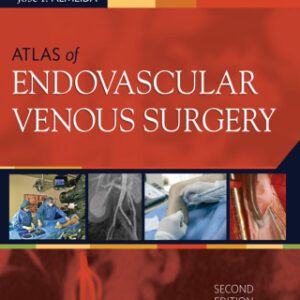 Atlas of Endovascular Venous Surgery: Expert Consult 2nd Edition - Original PDF