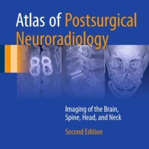 Atlas of Postsurgical Neuroradiology: Imaging of the Brain, Spine, Head, and Neck 2nd Edition - Original PDF