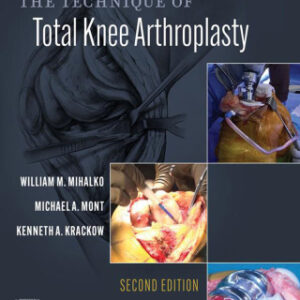 The Technique of Total Knee Arthroplasty E-Book 2nd Edition - Original PDF