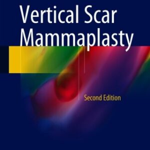 Vertical Scar Mammaplasty 2nd Edition - Original PDF