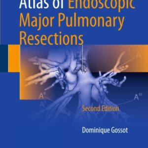 Atlas of Endoscopic Major Pulmonary Resections 2nd Edition - Original PDF