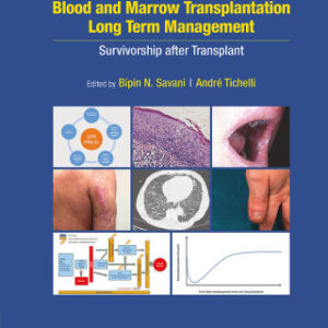 Blood and Marrow Transplantation Long Term Management 2nd Edition Survivorship after Transplant - Original PDF