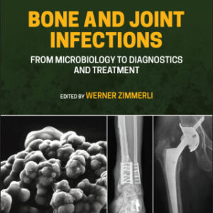 Bone and Joint Infections 2nd Edition From Microbiology to Diagnostics and Treatment - Original PDF