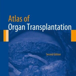 Atlas of Organ Transplantation 2nd Edition - Original PDF