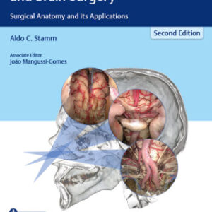 Transnasal Endoscopic Skull Base and Brain Surgery: Surgical Anatomy and its Applications 2nd Edition - Original PDF